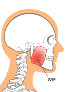 咬筋の場所の説明図