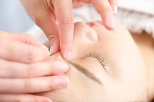 眉間に美容鍼を打っている様子