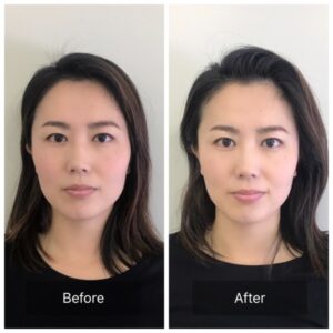 螻ｱ蝨ｰ縺輔ｓ1蝗樒岼