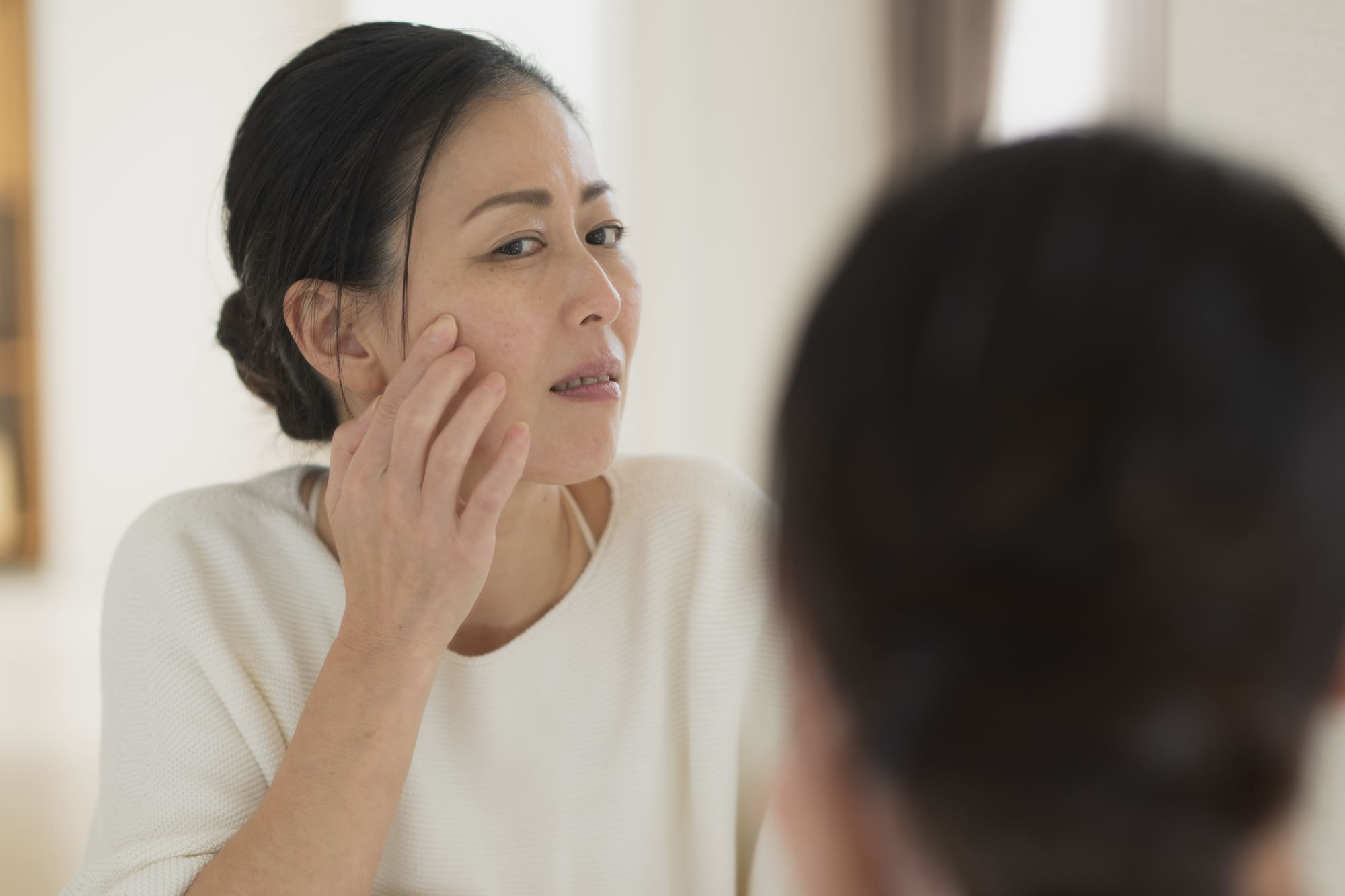 肌荒れ（美容鍼）